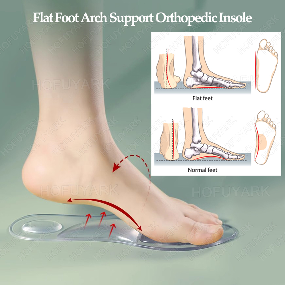 Wkładki żelowe silikonowe Orto – Women'S Shoes With Plantar Fasciitis recenzja i cena